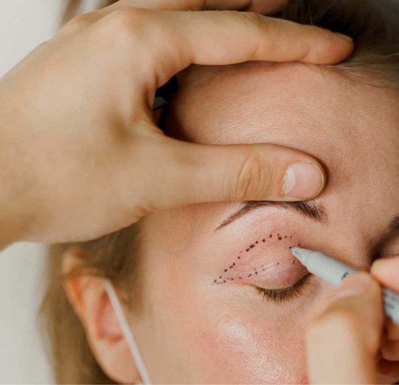 Schoonheidsoperaties